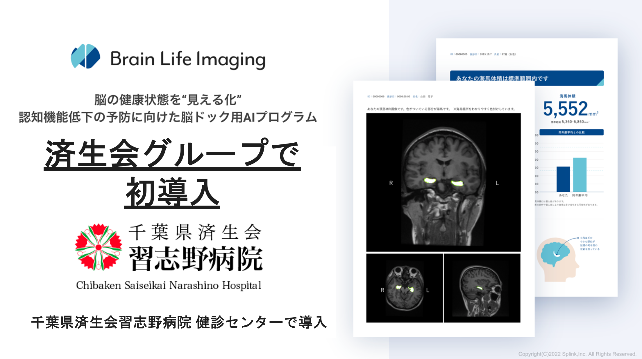 【済生会グループで初導入】脳ドック用AIプログラム「Brain Life Imaging®」が千葉県済生会習志野病院 健診センターで導入