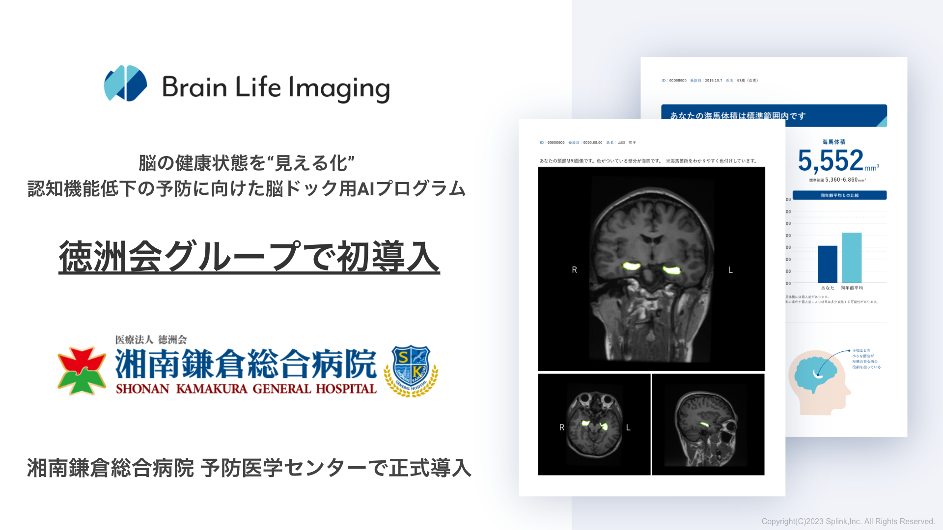 【徳洲会グループで初導入】脳ドック用AIプログラム「Brain Life Imaging®」が湘南鎌倉徳洲会総合病院 予防医学センターで正式導入